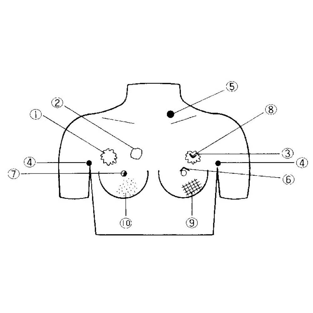 Brustkrebsvorsorge-Tastmodell, schematische Vorderansicht mit nummerierten Markierungen