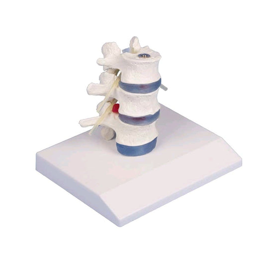 Modelli della colonna vertebrale