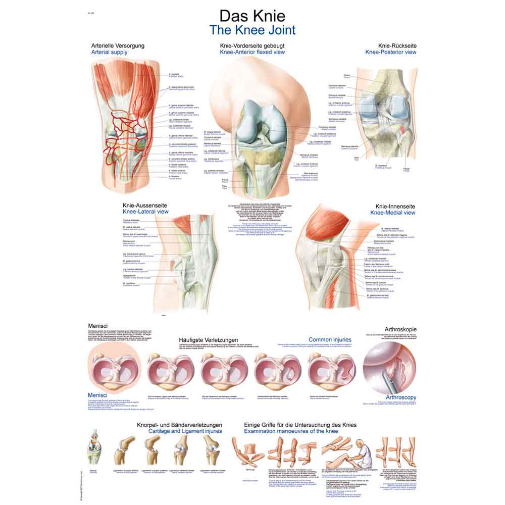 Knie-Lehrtafel mit beschrifteten Darstellungen von Meniskus und Knorpel