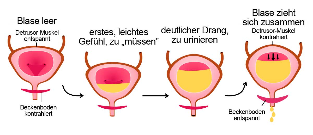 Grafische Ansicht der normalen Blasenfunktion ohne Inkontinenz