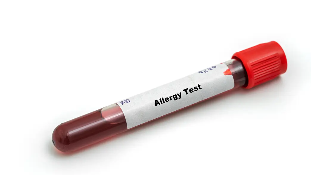 Großaufnahme eines Probenröhrchens mit einer Blutprobe und der Aufschrift „Allergy Test